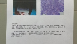 【卓越醫(yī)療在湖一】 微創(chuàng)“一把刀”，勇過(guò)“腎”命難關(guān)