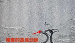 強化黨建引領(lǐng)優(yōu)勢，聚力卒中救治再創(chuàng)新高